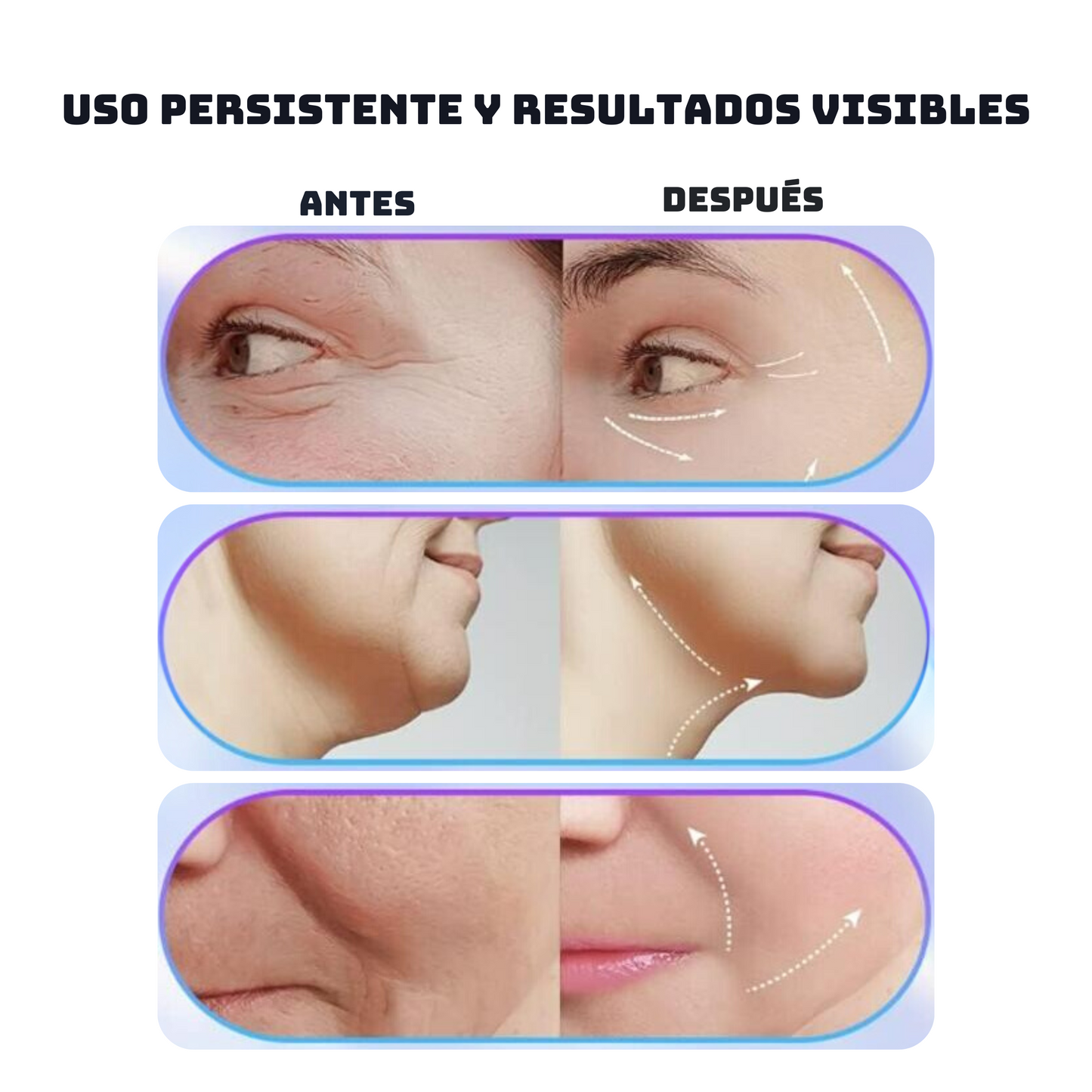 Masajeador Facial 3 en 1 + serum Aloe Vera 🍃🧖🏼‍♀️